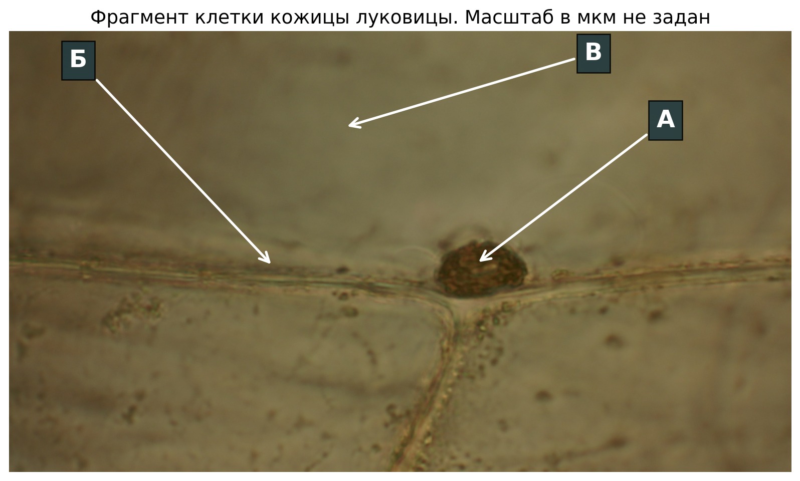 Микрофотография фрагмента живой клетки кожицы луковицы с метками А, Б, В для анализа. Berkshire Community College Bioscience Image Library, 04.05.2017, CC0. Оригинал без изменения содержания дополнен выносными метками; координаты изображения не являются физическим масштабом.